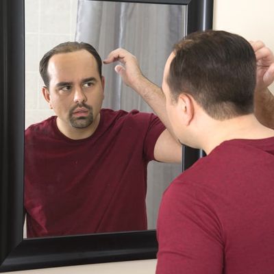 HairClub Causes and Conditions - a man wearing a burgundy t-shirt looks at his male pattern baldness receding hairline in a mirror.