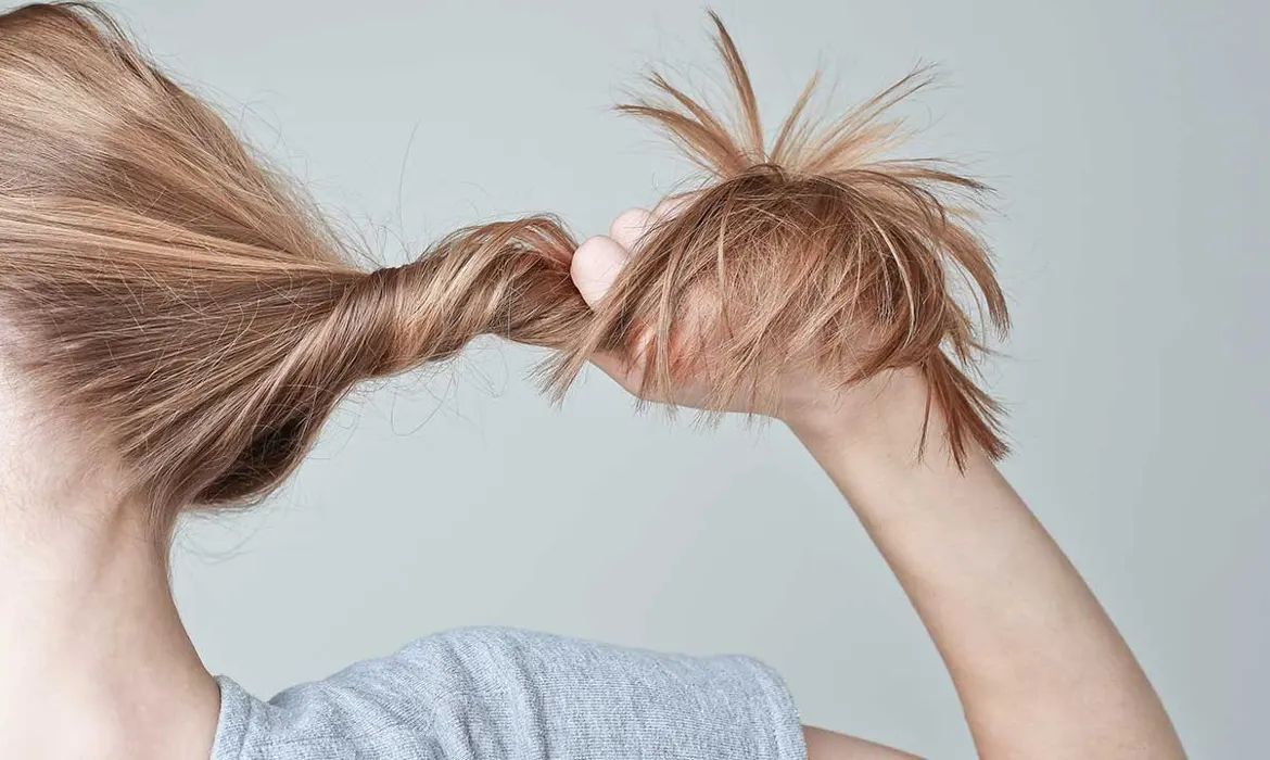 excessive-styling-can-trigger-a-type-of-hair-loss-called-traction-alopecia