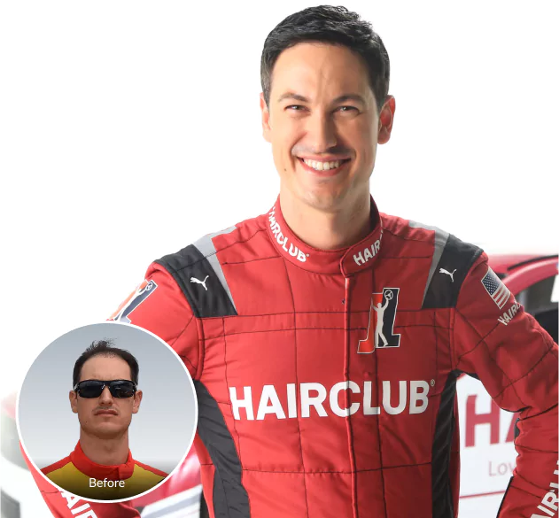 Celebrity Joey Logano - HairClub before and now portraits of Joey Logano - before showing his hair loss and now with his successful HairClub Xtrands+ solution.