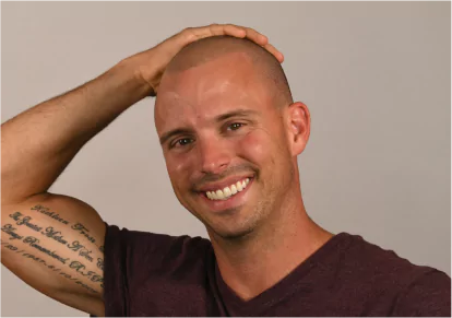 HairClub - Restorink - Low Maintenance Results - a man using his right hand to rub the top of his head where the RestorInk treatment was performed.